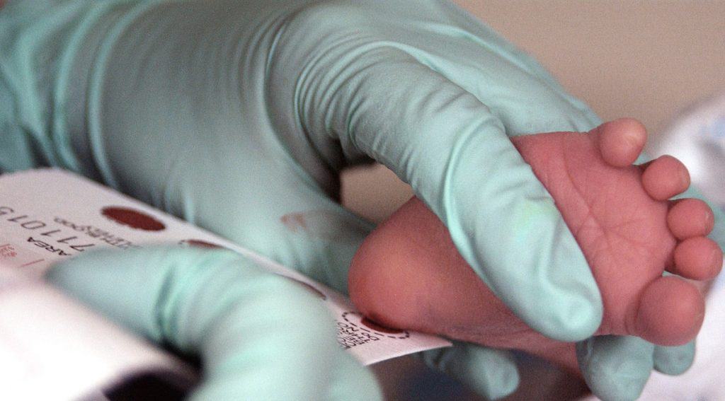 Newborn Screening for Sickle Cell begins in Ontario